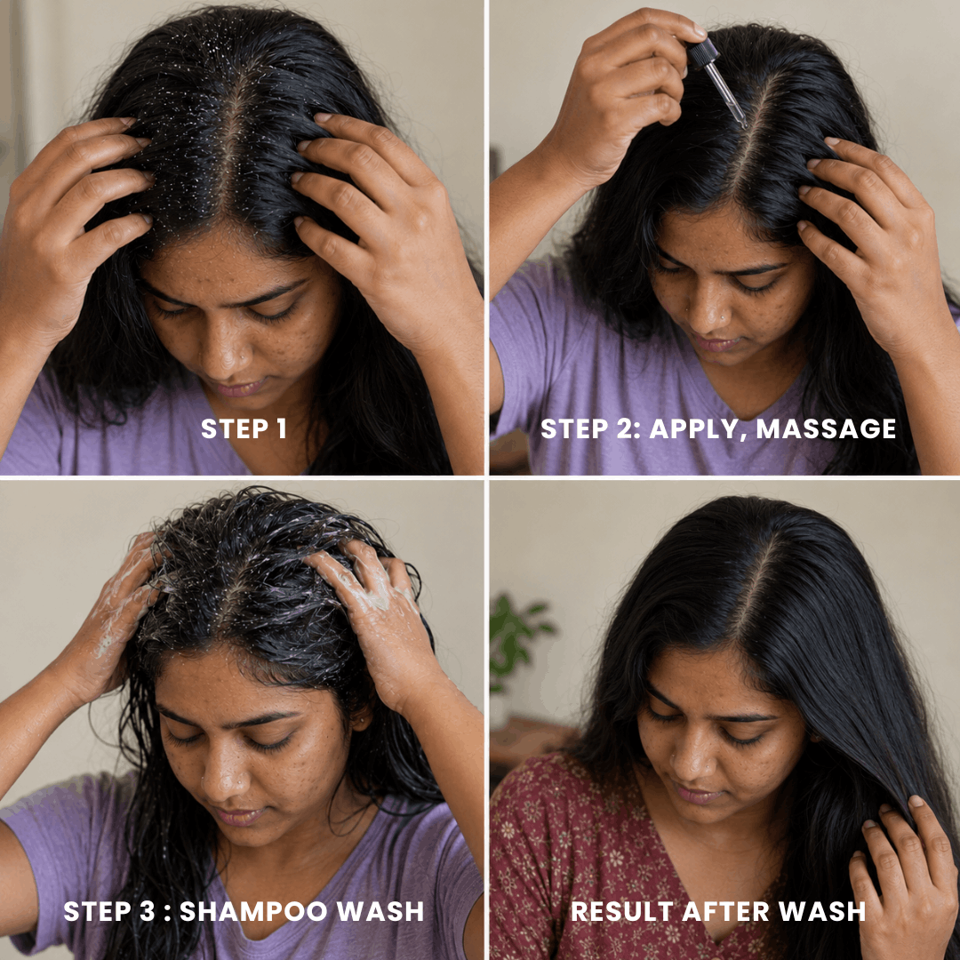 Anti-Dandruff Scalp Concentrate