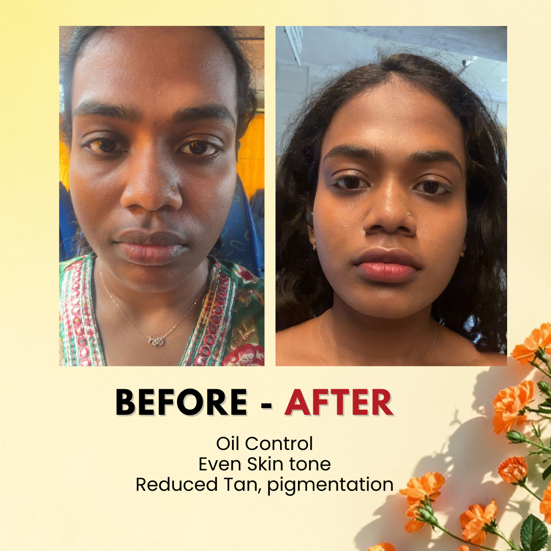 Tvishi Clear Skin Detan Bundle before and after — removes tan and evens skin tone naturally