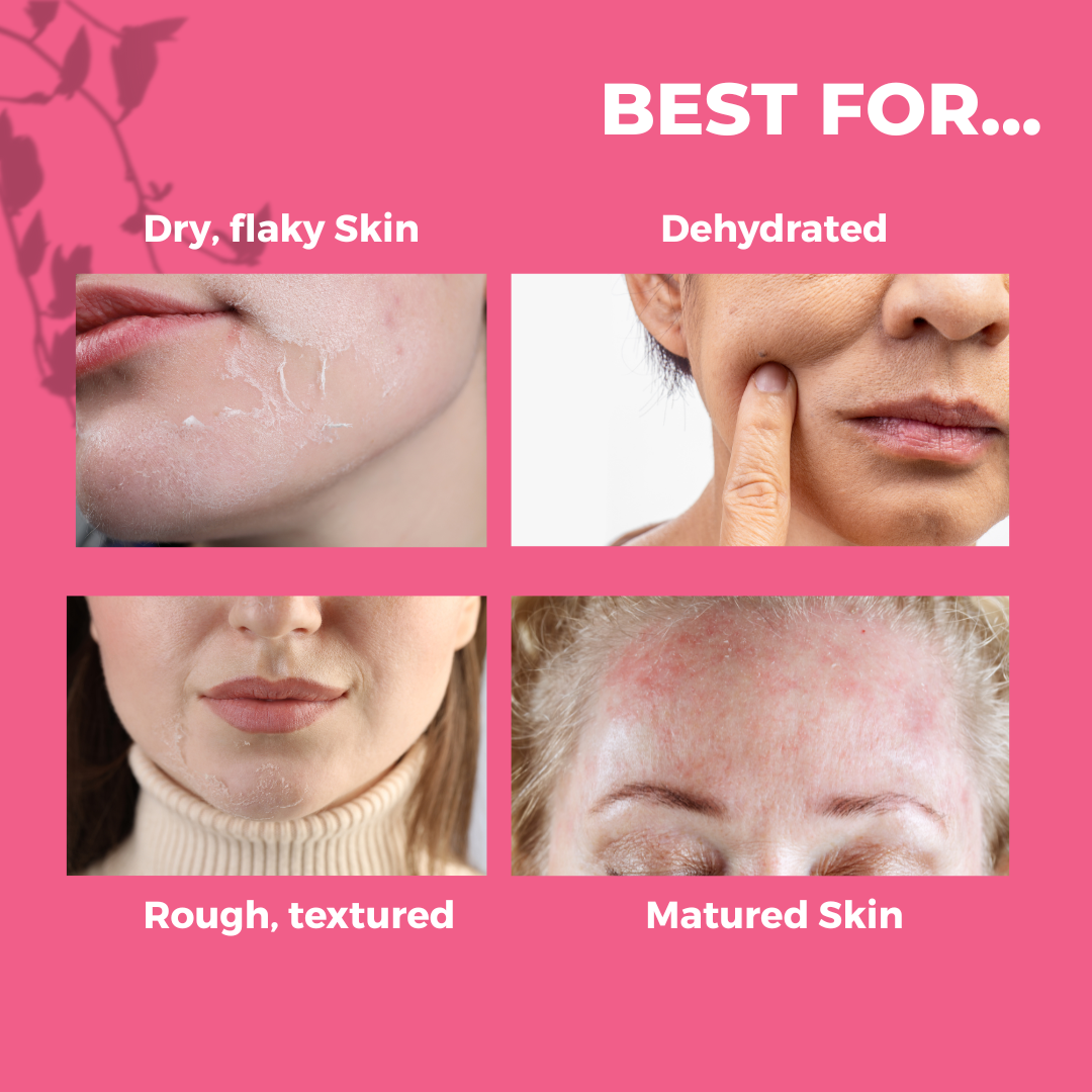 Tvishi rose moisturiser for soft and healthy skin
