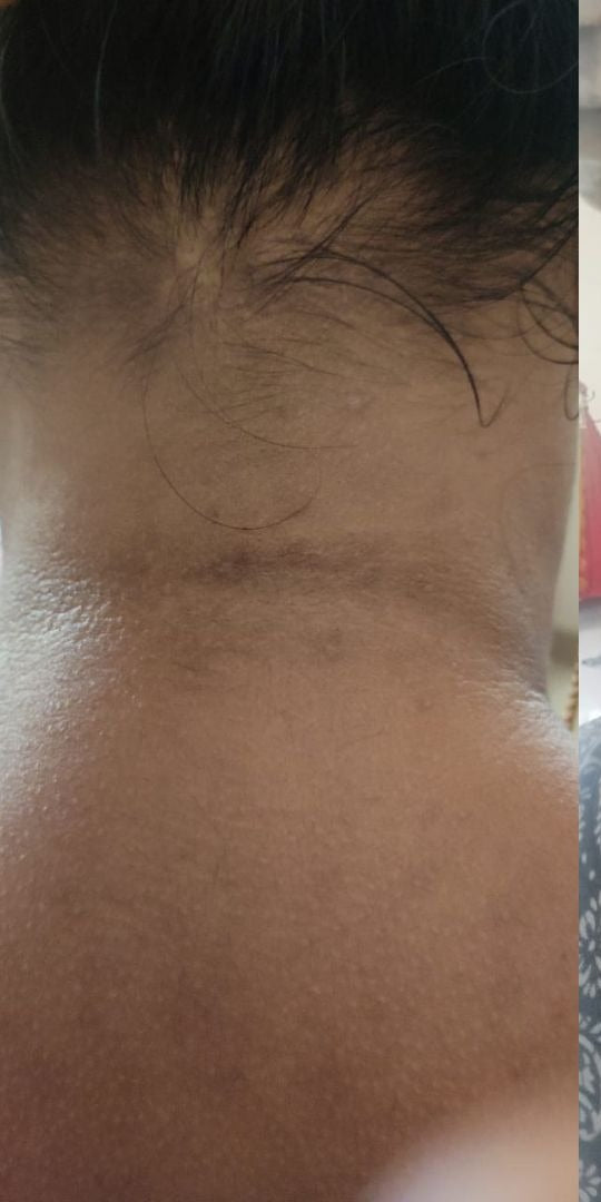 Before image for Pushpa