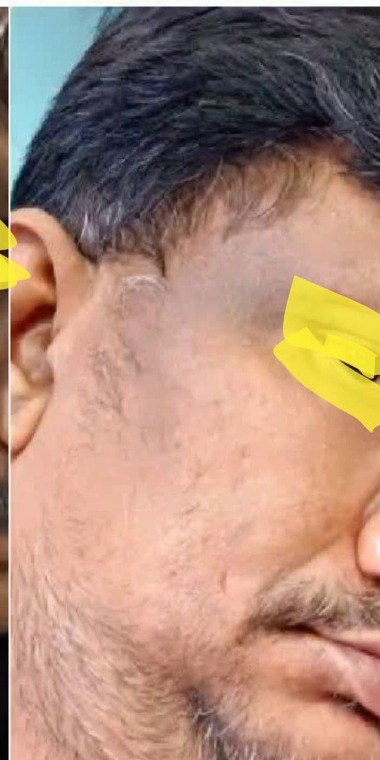 After image for Prakash