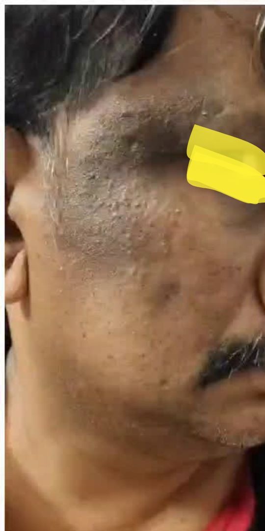 Before image for Prakash