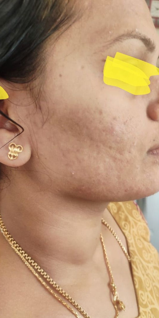 After image for Poorna